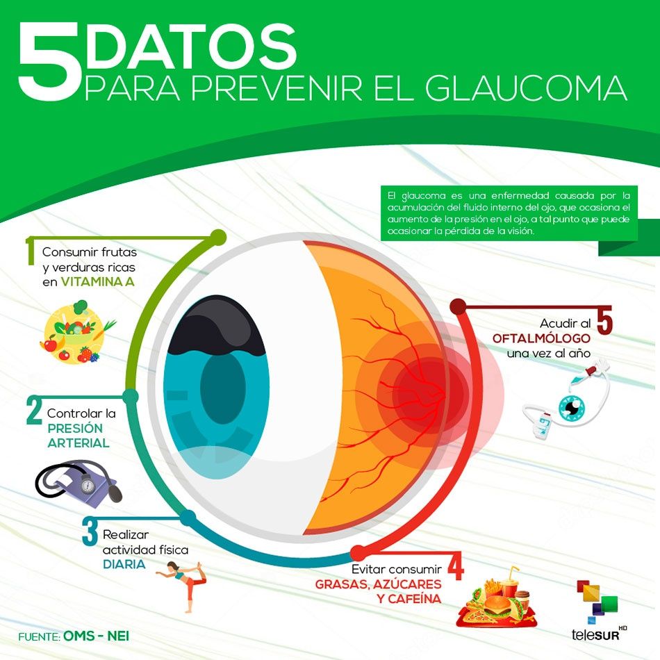 Cinco Datos Para Prevenir El Glaucoma Golpeando El Yunque 4680