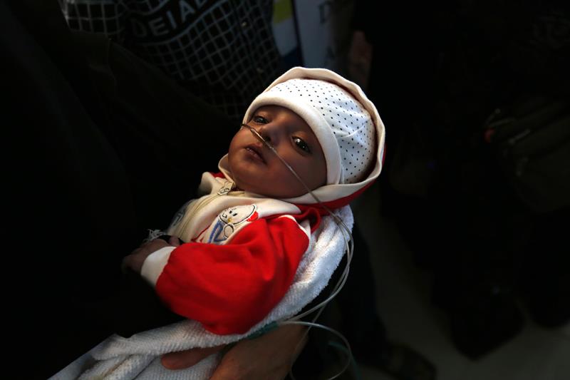 Unicef ha declarado que los yemeníes sufren 