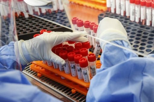 Un total de 17 organizaciones científicas en Rusia están desarrollando más de 25 vacunas distintas contra el nuevo coronavirus.