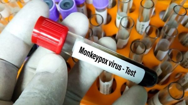 OMS insta a no realizar vacunaciones masivas contra viruela del mono